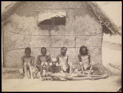 Famine in Mysore, India: six emaciated men wearing loin cloths, five sitting and one lying on a mat. Photograph attributed to Willoughby Wallace Hooper, 1876/1878.
