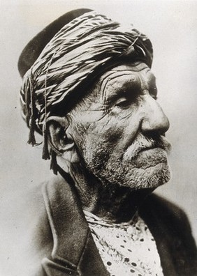 Zaro Agha, wearing a turban, in profile, reputedly at the age of 150 years. Photograph, ca. 1925.