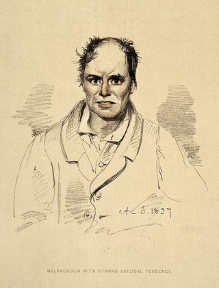 A man diagnosed as suffering from melancholia with strong suicidal tendency. Lithograph, 1892, after a drawing by Alexander Johnston, 1837, for Sir Alexander Morison.
