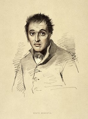 A man diagnosed as suffering from acute dementia. Lithograph, 1892, after a drawing by Alexander Johnston, 1836/1841, for Sir Alexander Morison.