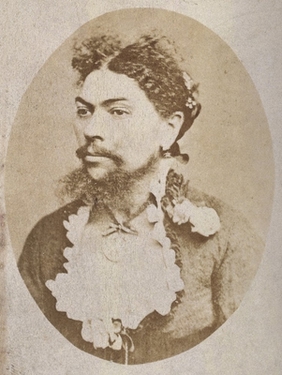 A woman with a moustache and beard: head and shoulders. Photograph.