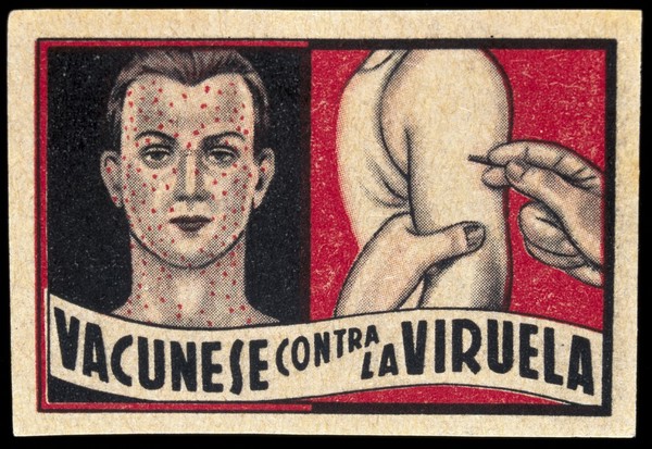 (Left) face of a man suffering from smallpox; (right) vaccination against smallpox. Colour process print.