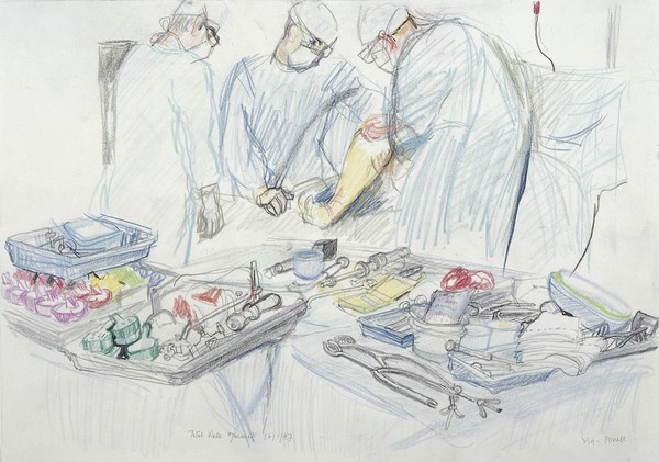 A surgical operation: total knee replacement. Drawing by Virginia Powell, 1997.