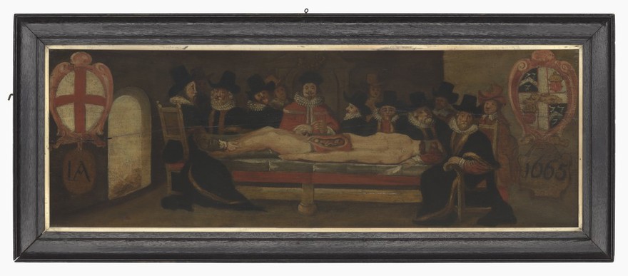 The dissection of a corpse before a company of surgeons (?). Oil painting.