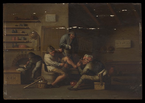 A surgeon operating on a man's foot. Oil painting attributed to Cornelis Mahu after Adriaen van Ostade.