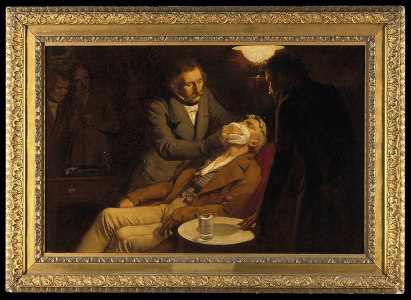 The first use of ether in dental surgery, 1846. Oil painting by Ernest Board.