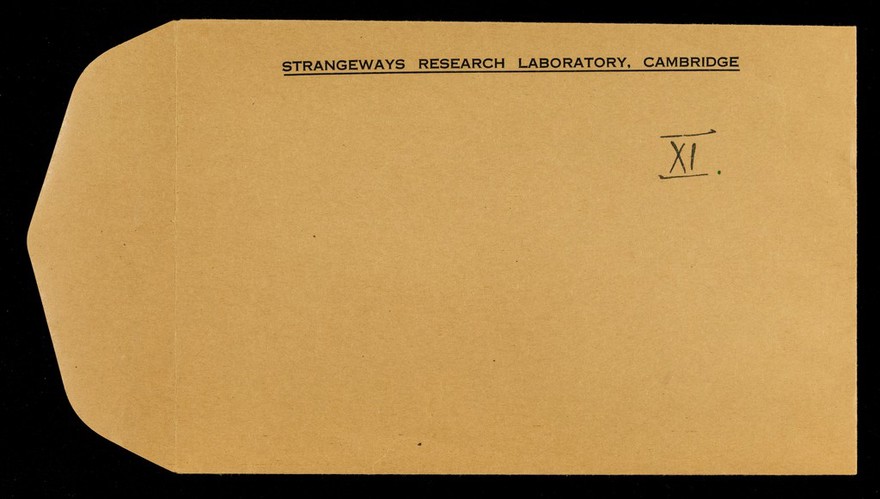 Strangeways Research Laboratory, Cambridge.