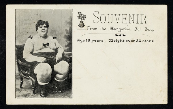 Souvenir from the Hungarian Fat Boy : age 18 years. Weight over 30 stone.