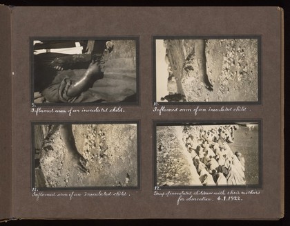 Smallpox epidemic, Palestine. Photograph album, ca. 1922.