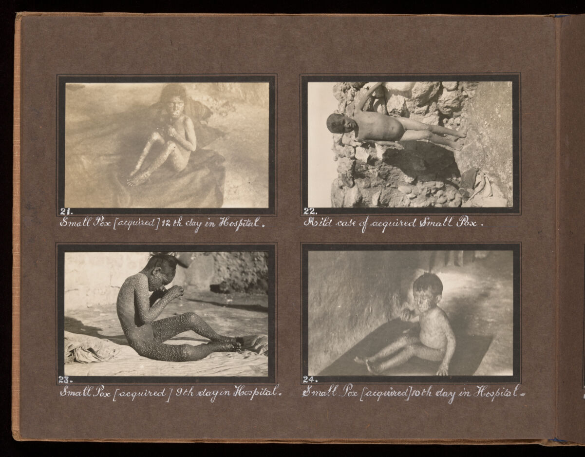 Smallpox epidemic, Palestine. Photograph album, ca. 1922.