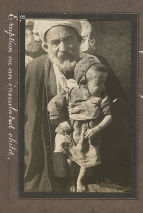 Smallpox epidemic, Palestine. Photograph album, ca. 1922.