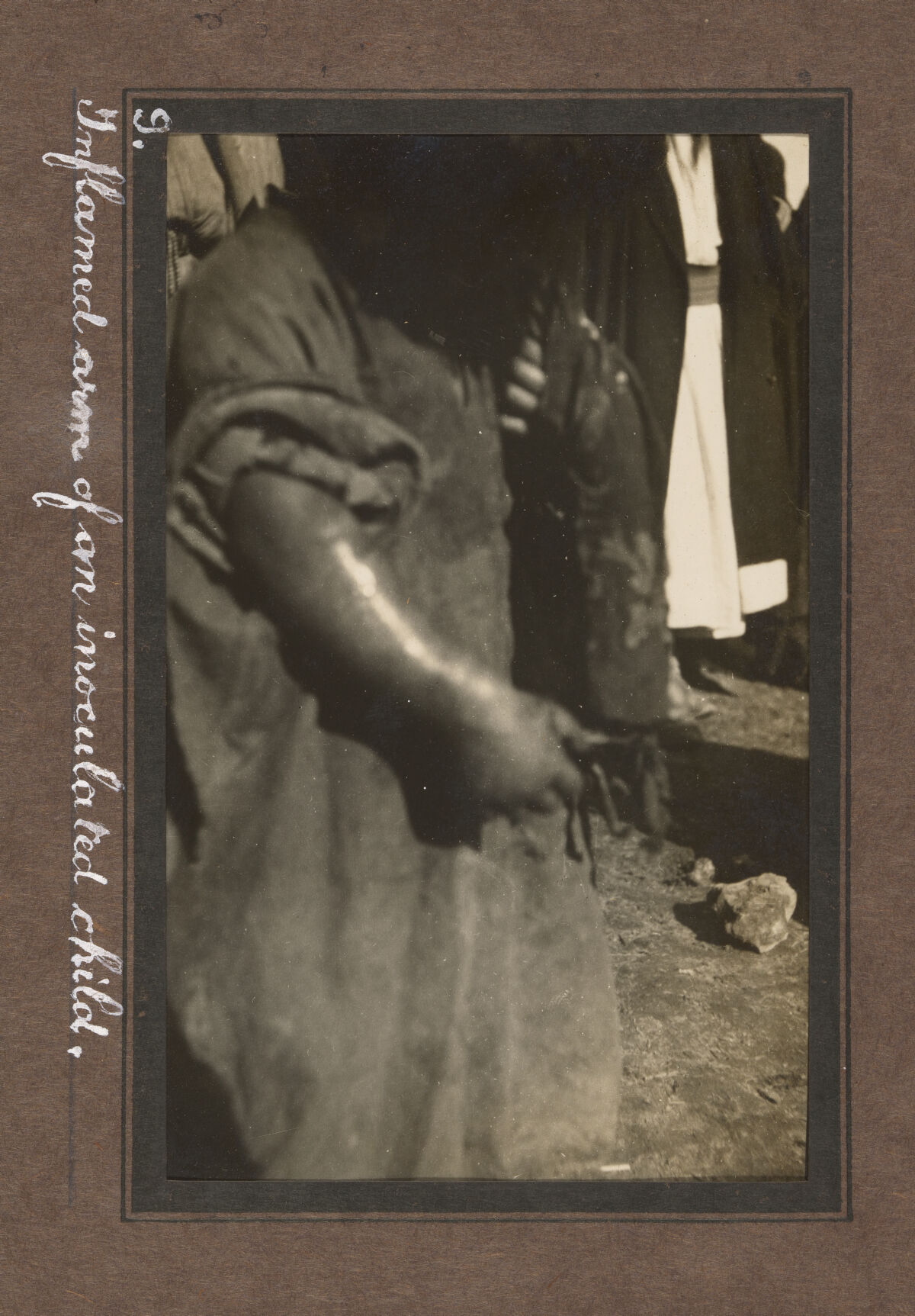 Smallpox epidemic, Palestine. Photograph album, ca. 1922.
