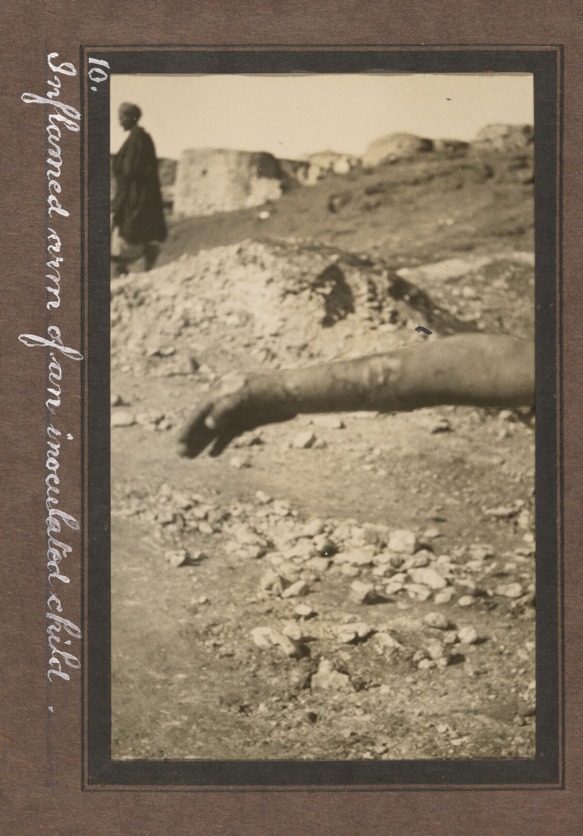 Smallpox epidemic, Palestine. Photograph album, ca. 1922.