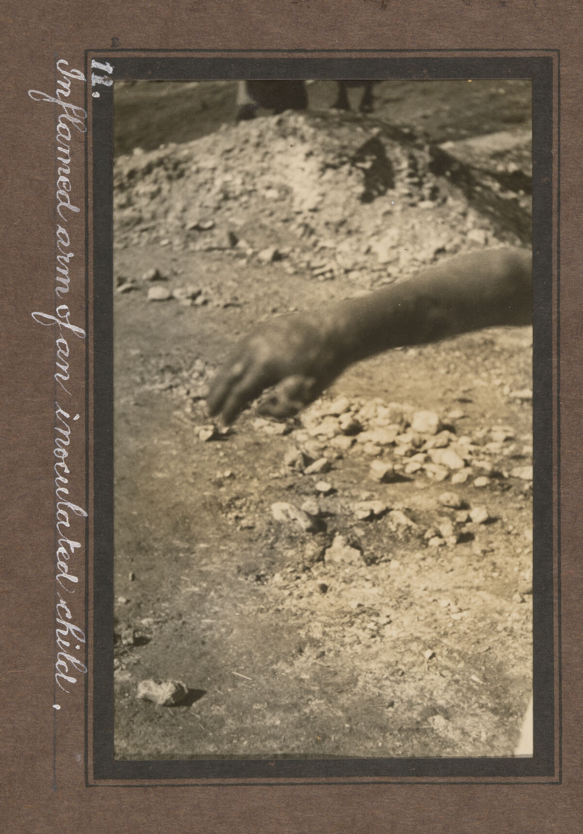 Smallpox epidemic, Palestine. Photograph album, ca. 1922.