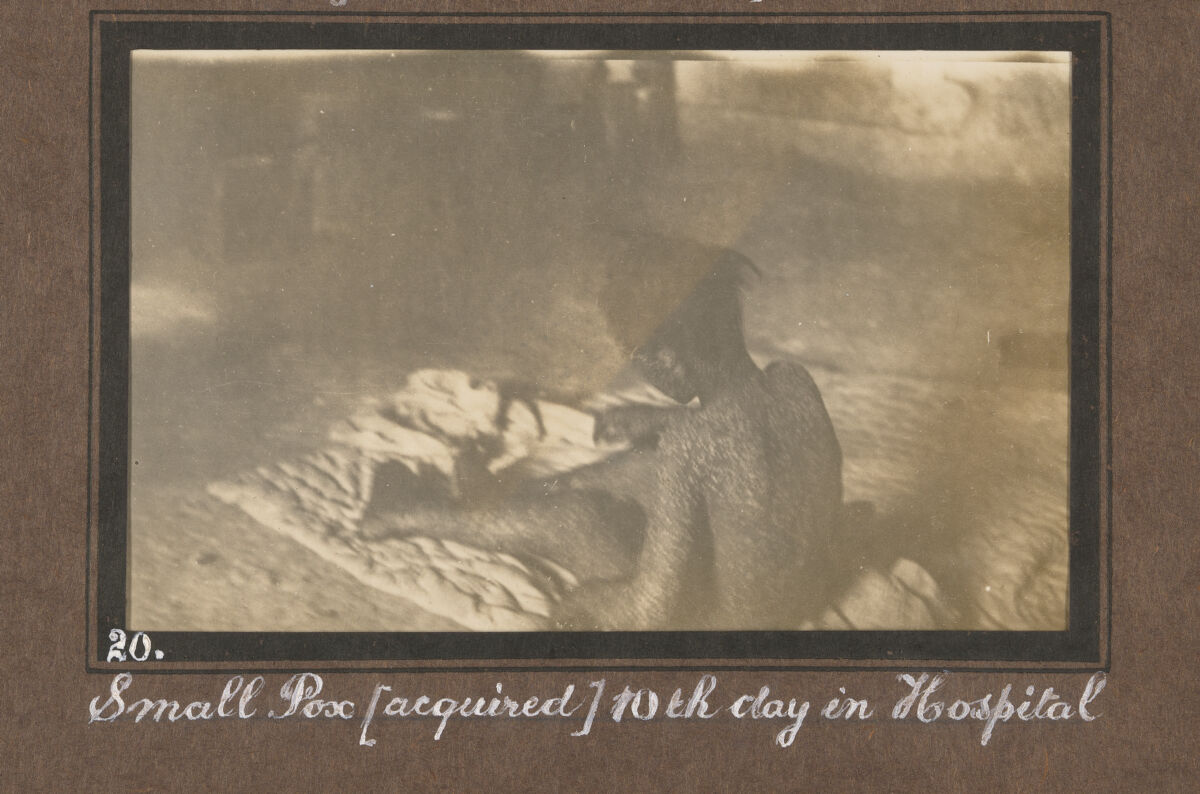 Smallpox epidemic, Palestine. Photograph album, ca. 1922.
