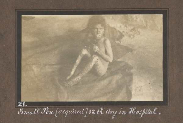 Smallpox epidemic, Palestine. Photograph album, ca. 1922.