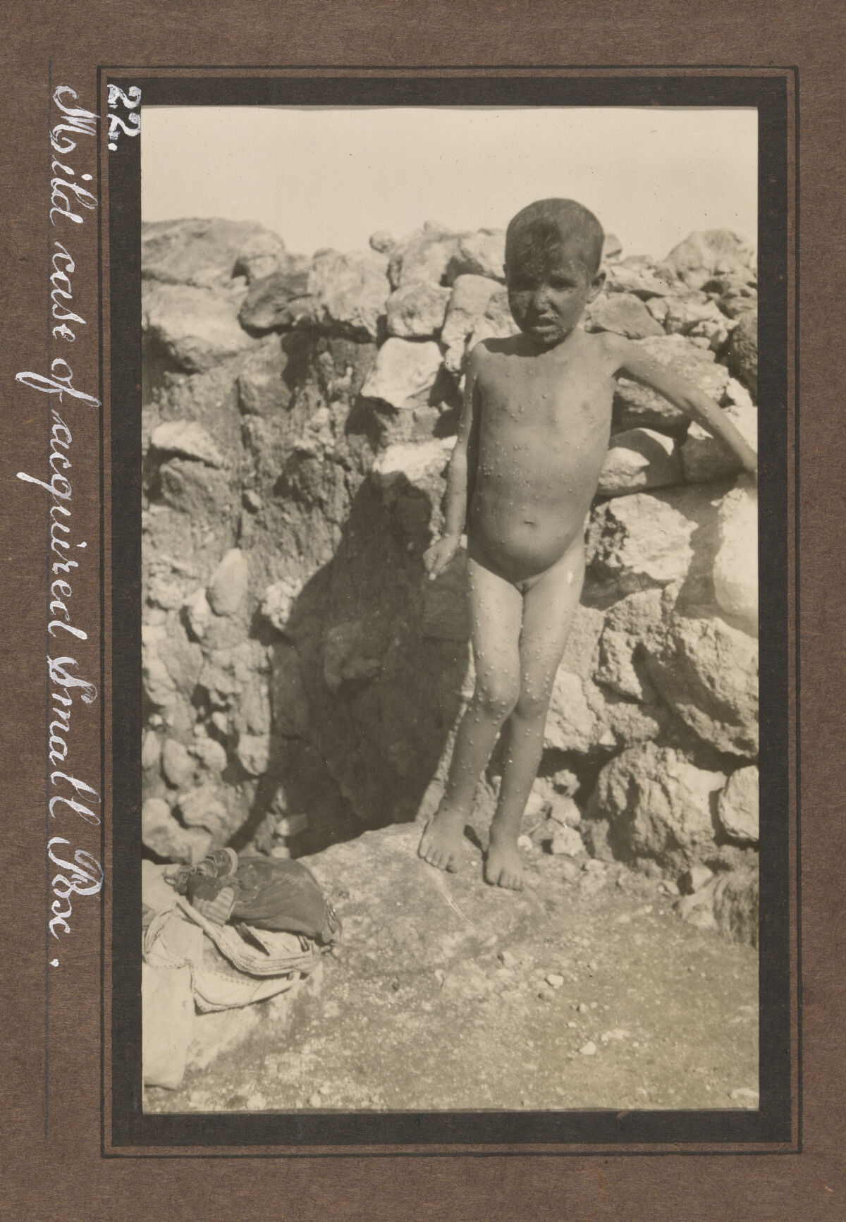 Smallpox epidemic, Palestine. Photograph album, ca. 1922.