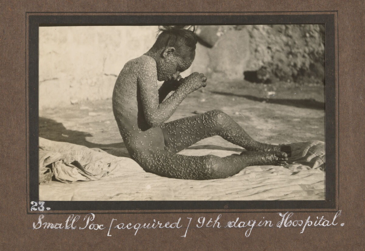 Smallpox epidemic, Palestine. Photograph album, ca. 1922.