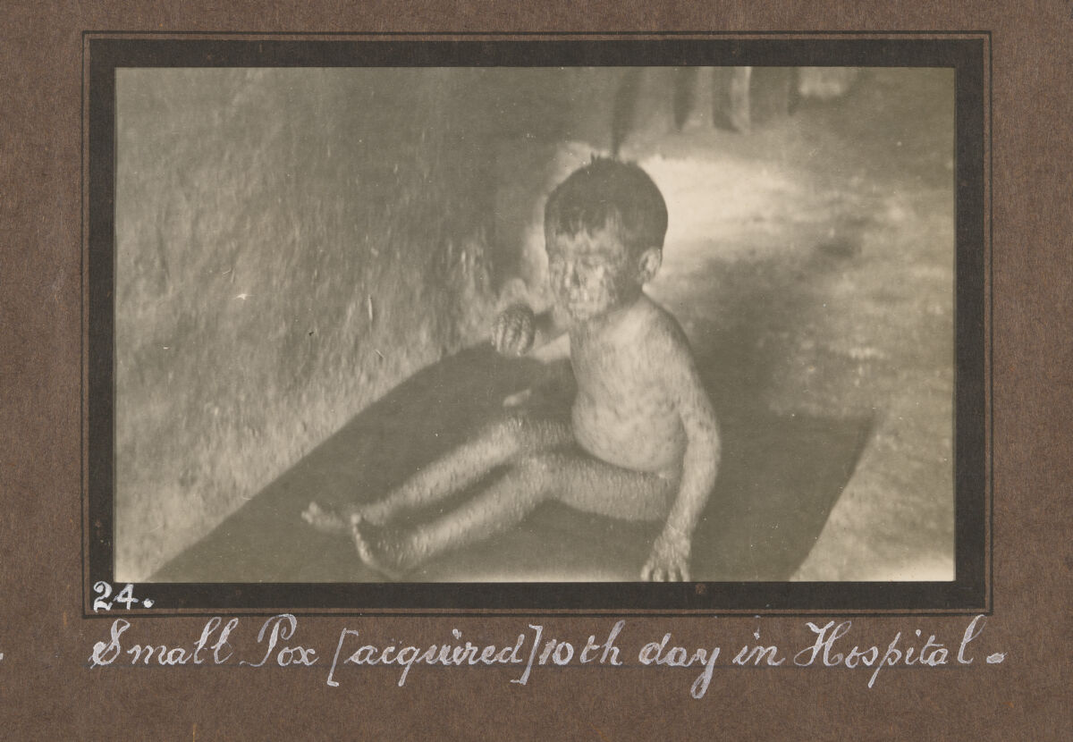 Smallpox epidemic, Palestine. Photograph album, ca. 1922.