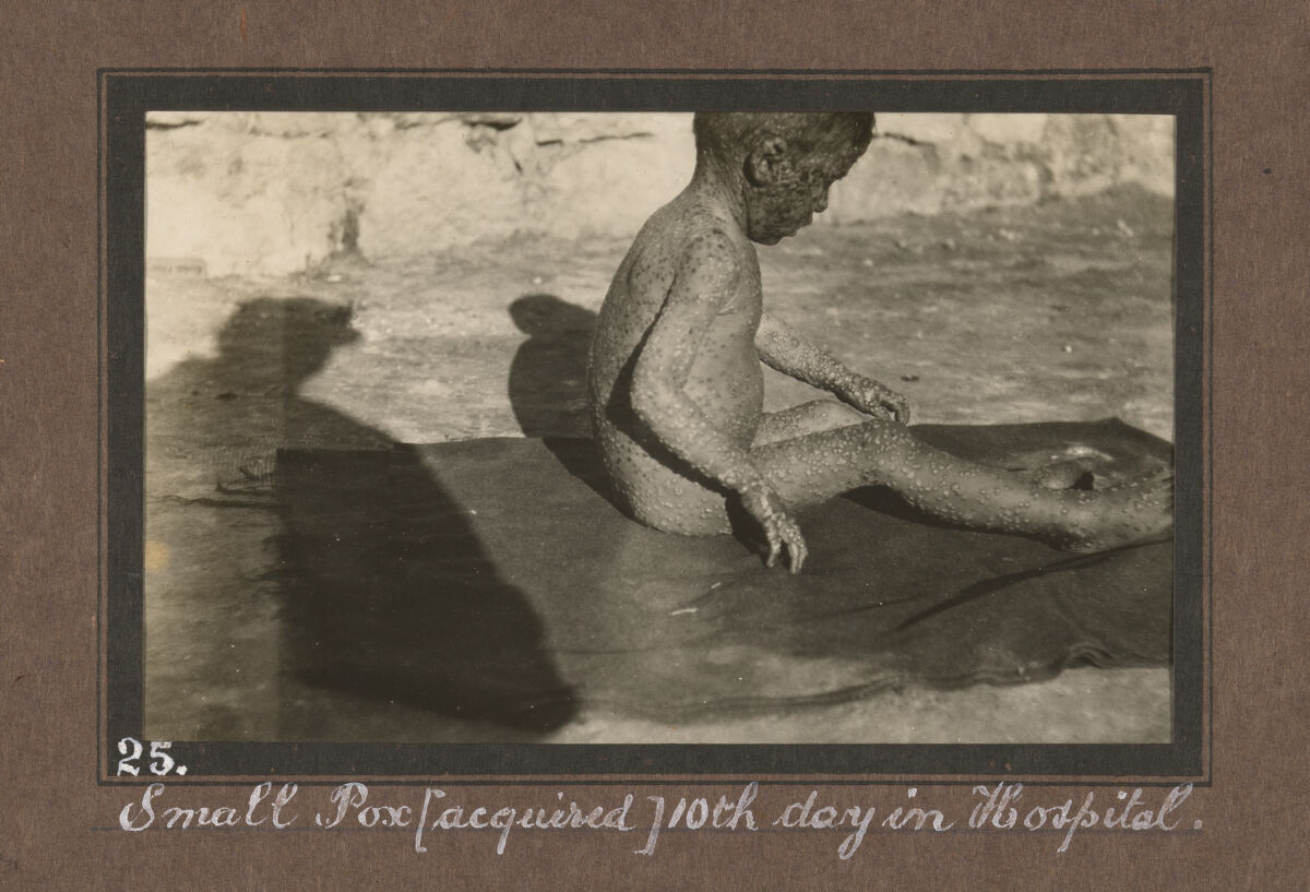 Smallpox epidemic, Palestine. Photograph album, ca. 1922.