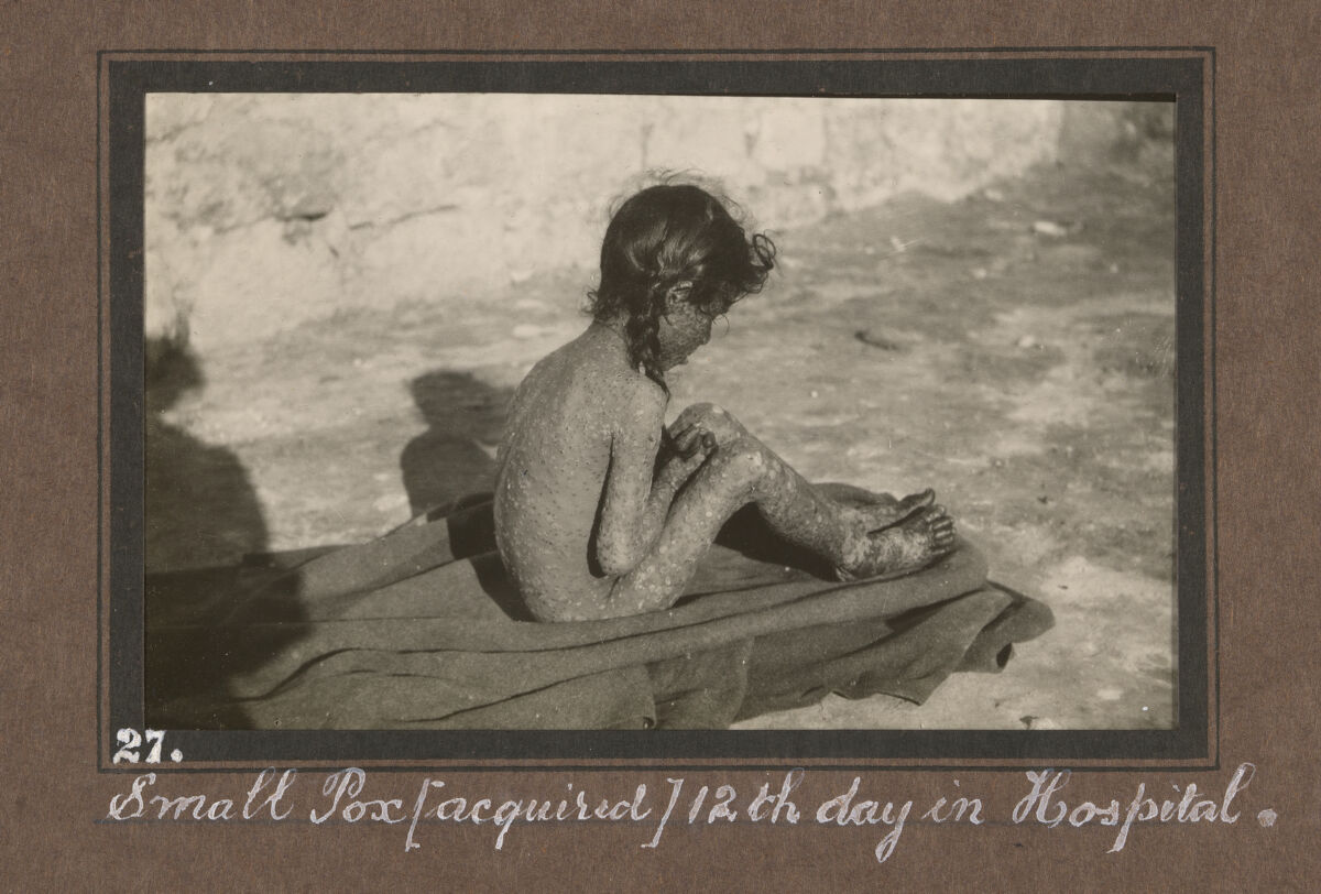 Smallpox epidemic, Palestine. Photograph album, ca. 1922.