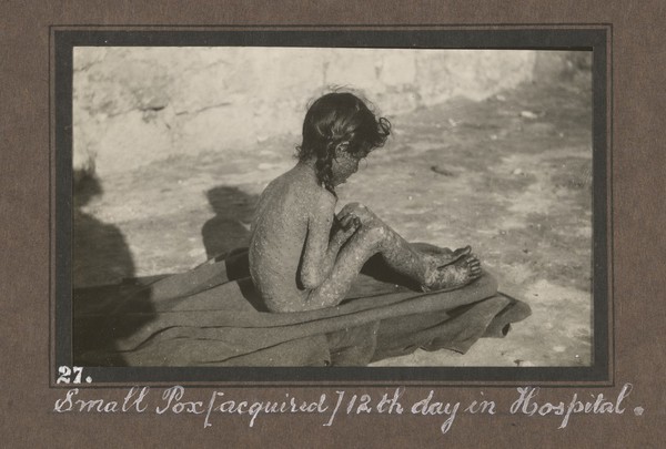 Smallpox epidemic, Palestine. Photograph album, ca. 1922.