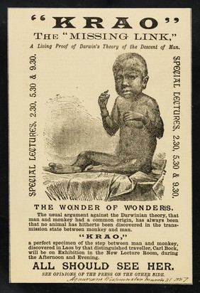 "Krao", the "missing link" : a living proof of Darwin's theory of the descent of man : special lectures, 2.30, 5.30 & 9.30... : all should see her : [seated illustration].