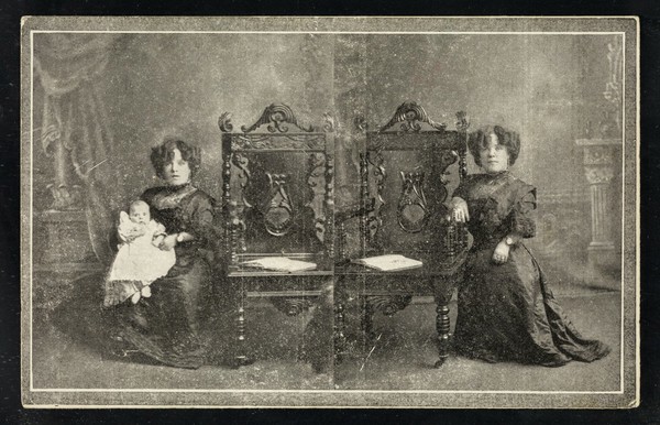 Post card : [2 views of a female midget with a baby next to a carved chair].