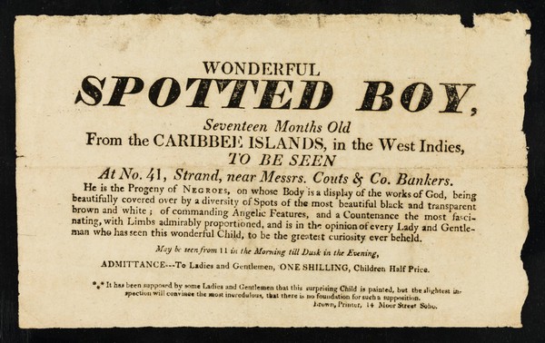 Wonderful spotted boy : seventeen months old from the Caribbee islands, in the West Indies : to be seen at no.41, Strand, near Messrs. Couts & Co. bankers : he is the progeny of negroes, on whose body is a display of the works of God, being beautifully covered by a diversity of spots of the most beautiful black and transparent brown and white.