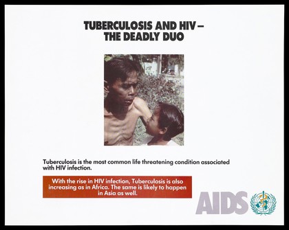 A skeletal Asian man who has tuberculosis with a child representing a warning about the dangers of tuberculosis and HIV by the World Health Organization (WHO). Colour lithograph, ca. 1995.