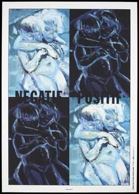 Positive and negative paintings of children hugging each other, referring to children who are HIV positive or negative. Colour silk screen print after M. Dumas, 1993.