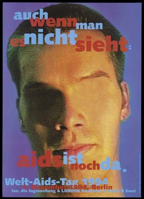 The face of a man with one eye airbrushed out; advertising World AIDS Day, 1 December 1994. Colour lithograph by Jan Kesting, 1994.