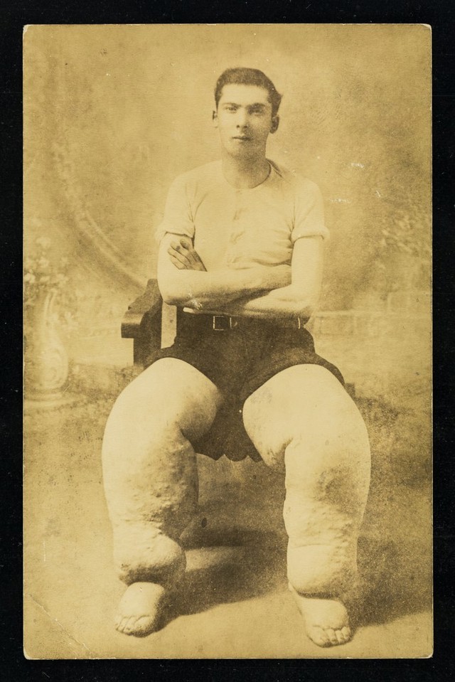 No text description is available for this image