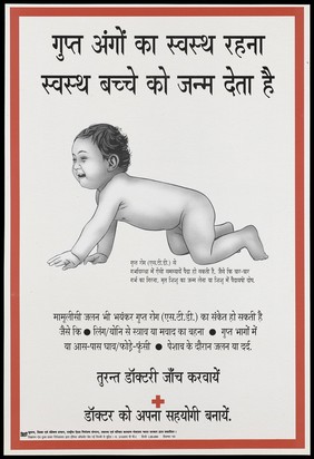 A baby crawling to the left representing a warning about good sexual health to prevent birth defects, STDs and AIDS (Hindi version); a warning to seek treatment for STD's by the National AIDS Control Project in New Delhi. Colour lithograph, 1995.