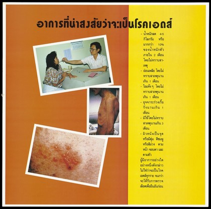 A doctor places a thermometer in a female patient's mouth, an emaciated man and a skin rash representing a message about symptoms that suggest you have AIDS; one of a series of 4 AIDS education posters by the Population and Community Development Association (PDA) in Thailand. Colour lithograph, ca. 1995.