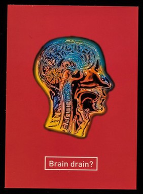Brain drain? : depression, mood swings, risk-taking, mid-week blues, rage, lethargy, low self-esteem, neglect, emotional... / Camden & Islington Community Health Services NHS Trust ; designed by Eureka! Graphic Design Limited.