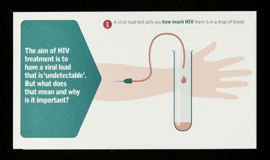 Undetectable viral load / NAM.