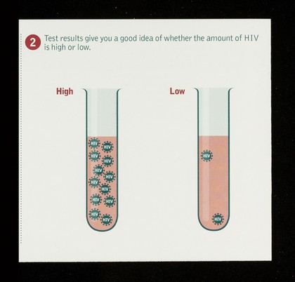 Undetectable viral load / NAM.