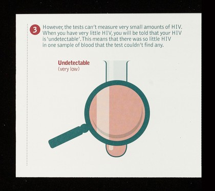 Undetectable viral load / NAM.