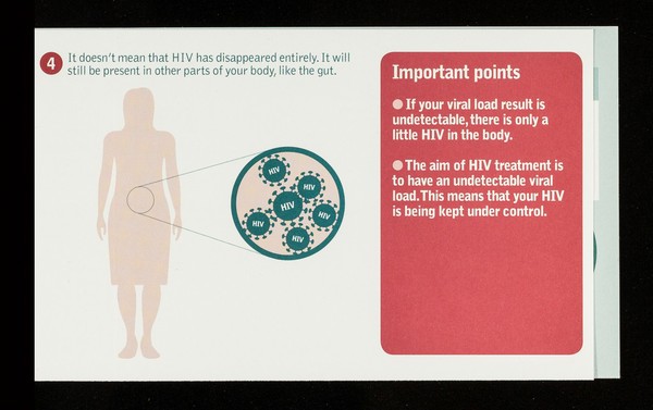 Undetectable viral load / NAM.