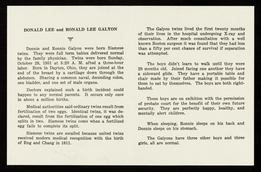 Galyon siamese twins : no.1 phenomenal sensation of the show world : two heads, four arms, four legs, one body : Donnie, Ronnie, alive.