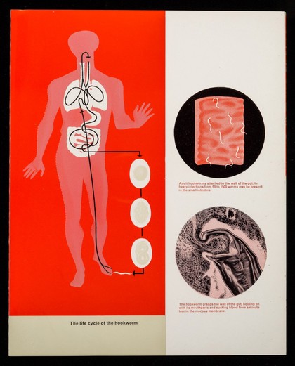 The modern answer to ancylostomiasis and ascariasis : Alcopar dispersable granules, the proven treatment for hookworm / Burroughs Wellcome & Co.