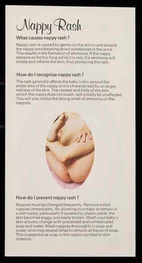 Nappy rash, teething : your questions answered / Wellcome Foundation Ltd.