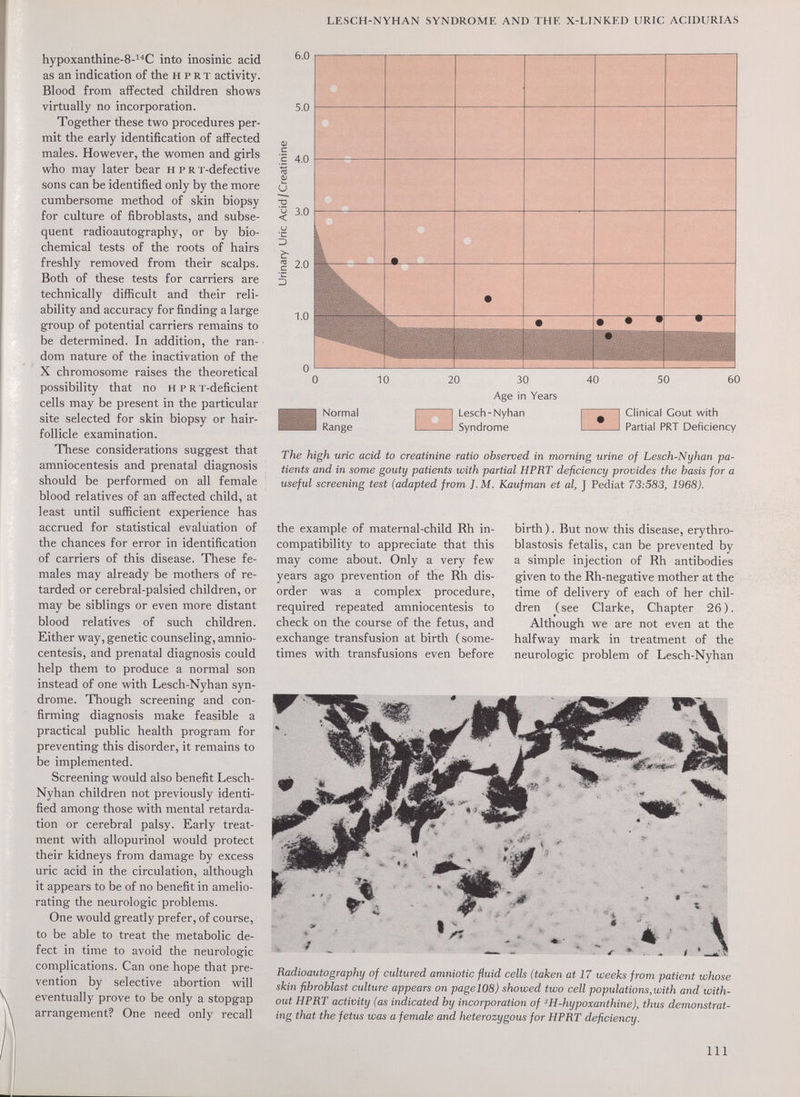 LE.SCH-NYHAN SYNDROME AND THE X-LINKKD URIC ACIDURIAS hypoxanthine-8-^''C into inosinic acid as an indication of the н p r т activity. Blood from affected children shows virtually no incorporation. Together these tvv^o procedures per¬ mit the early identification of affected males. However, the women and girls who may later bear н p R T-defective sons can be identified only by the more cumbersome method of skin biopsy for culture of fibroblasts, and subse¬ quent radioautography, or by bio¬ chemical tests of the roots of hairs freshly removed from their scalps. Both of these tests for carriers are technically difficult and their reli¬ ability and accuracy for finding a large group of potential carriers remains to be determined. In addition, the ran¬ dom nature of the inactivation of the X chromosome raises the theoretical possibility that no н p r т-deficient cells may be present in the particular site selected for skin biopsy or hair- follicle examination. These considerations suggest that amniocentesis and prenatal diagnosis should be performed on all female blood relatives of an affected child, at least until sufficient experience has accrued for statistical evaluation of the chances for error in identification of carriers of this disease. These fe¬ males may already be mothers of re¬ tarded or cerebral-palsied children, or may be siblings or even more distant blood relatives of such children. Either way, genetic counseling, amnio¬ centesis, and prenatal diagnosis could help them to produce a normal son instead of one with Lesch-Nyhan syn¬ drome. Though screening and con¬ firming diagnosis make feasible a practical public health program for preventing this disorder, it remains to be implemented. Screening would also benefit Lesch- Nyhan children not previously identi¬ fied among those with mental retarda¬ tion or cerebral palsy. Early treat¬ ment with allopurinol would protect their kidneys from damage by excess uric acid in the circulation, although it appears to be of no benefit in amelio¬ rating the neurologic problems. One would greatly prefer, of course, to be able to treat the metabolic de¬ fect in time to avoid the neurologic complications. Can one hope that pre¬ vention by selective abortion will eventually prove to be only a stopgap arrangement? One need only recall 6.0 Normal Range 3 30 40 Age in Years Lesch-Nyhan Syndrome Clinical Gout with Partial PRT Deficiency The high uric acid to creatinine ratio observed in morning urine of Lesch-Nyhan pa¬ tients and in some gouty patients with partial HPRT deficiency provides the basis for a useful screening test (adapted from ]. M. Kaufman et al, J Pediat 73:583, 1968). the example of maternal-child Rh in¬ compatibility to appreciate that this may come about. Only a very few years ago prevention of the Rh dis¬ order was a complex procedure, required repeated amniocentesis to check on the course of the fetus, and exchange transfusion at birth (some¬ times with transfusions even before birth ). But now this disease, erythro¬ blastosis fetalis, can be prevented by a simple injection of Rh antibodies given to the Rh-negative mother at the time of delivery of each of her chil¬ dren (see Clarke, Chapter 26). Although we are not even at the halfway mark in treatment of the neurologic problem of Lesch-Nyhan Radioautography of cultured amniotic fluid cells (taken at 17 weeks from patient whose skin fibroblast culture appears on page 108) showed two cell populations, with and with¬ out HPRT activity (as indicated by incorporation of Ш-hypoxanthine), thus demonstrat¬ ing that the fetus was a female and heterozygous for HPRT deficiency. Ill