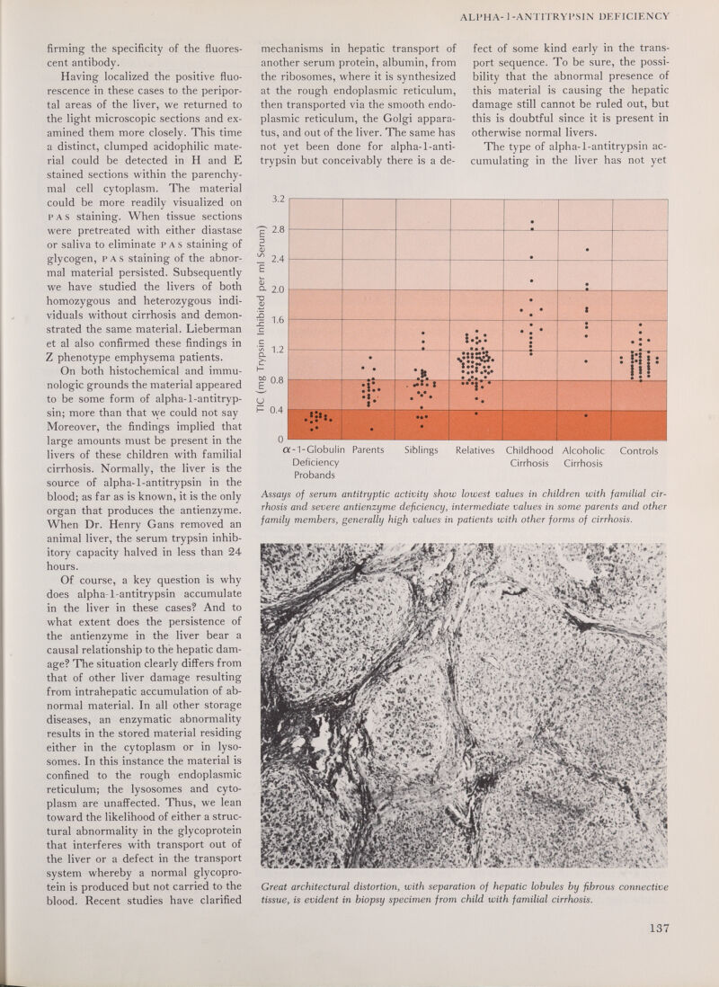 AH'HA- ] -ANTITRYPSIN DEFICIENCY firming the specificity of the fluores¬ cent antibody. Having localized the positive fluo¬ rescence in these cases to the peripor¬ tal areas of the liver, we returned to the light microscopic sections and ex¬ amined them more closely. This time a distinct, clumped acidophilic mate¬ rial could be detected in H and E stained sections within the parenchy¬ mal cell cytoplasm. The material could be more readily visualized on PAS staining. When tissue sections were pretreated with either diastase or saliva to eliminate pas staining of glycogen, PAS staining of the abnor¬ mal material persisted. Subsequently we have studied the livers of both homozygous and heterozygous indi¬ viduals without cirrhosis and demon¬ strated the same material. Lieberman et al also confirmed these findings in Z phenotype emphysema patients. On both histochemical and immu¬ nologic grounds the material appeared to be some form of alpha-1-antitryp- sin; more than that луе could not say Moreover, the findings implied that large amounts must be present in the livers of these children with familial cirrhosis. Normally, the liver is the source of alpha-1-antitrypsin in the blood; as far as is known, it is the only organ that produces the antienzyme. When Dr. Henry Gans removed an animal liver, the serum trypsin inhib¬ itory capacity halved in less than 24 hours. Of course, a key question is why does alpha-1-antitrypsin accumulate in the liver in these cases? And to what extent does the persistence of the antienzyme in the liver bear a causal relationship to the hepatic dam¬ age? The situation clearly differs from that of other liver damage resulting from intrahepatic accumulation of ab¬ normal material. In all other storage diseases, an enzymatic abnormality results in the stored material residing either in the cytoplasm or in lyso- somes. In this instance the material is confined to the rough endoplasmic reticulum; the lysosomes and cyto¬ plasm are unaffected. Thus, we lean toward the likelihood of either a struc¬ tural abnormality in the glycoprotein that interferes with transport out of the liver or a defect in the transport system whereby a normal glycopro¬ tein is produced but not carried to the blood. Recent studies have clarified mechanisms in hepatic transport of another serum protein, albumin, from the ribosomes, where it is synthesized at the rough endoplasmic reticulum, then transported via the smooth endo¬ plasmic reticulum, the Golgi appara¬ tus, and out of the liver. The same has not yet been done for alpha-1-anti- trypsin but conceivably there is a de¬ fect of some kind early in the trans¬ port sequence. To be sure, the possi¬ bility that the abnormal presence of this material is causing the hepatic damage still cannot be ruled out, but this is doubtful since it is present in otherwise normal livers. The type of alpha-1-antitrypsin ac¬ cumulating in the liver has not yet a-1-Clobulin Parents Siblings Relatives Childhood Alcoholic Controls Deficiency Cirrhosis Cirrhosis Probands Assays of serum antitryptic activity show lowest values in children with familial cir¬ rhosis and severe antienzyme deficiency, intermediate values in some parents and other family members, generally high values in patients with other forms of cirrhosis. Great architectural distortion, with separation of hepatic lobules by fibrous connective tissue, is evident in biopsy specimen from child with familial cirrhosis. 137