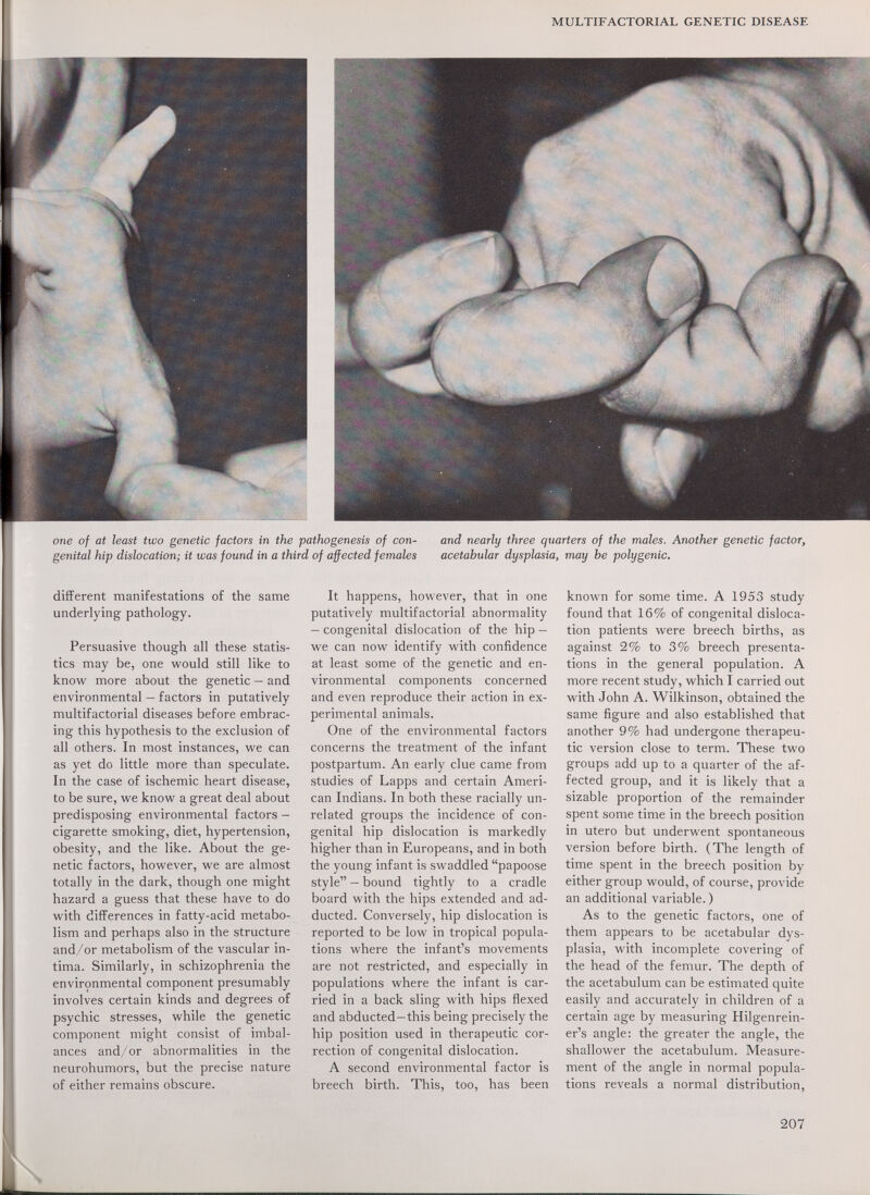 MULTIFACTORIAL GENETIC DISEASE one of at least two genetic factors in the pathogenesis of con¬ genital hip dislocation; it was found in a third of affected females and nearly three quarters of the males. Another genetic factor, acetabular dysplasia, may he polygenic. different manifestations of the same underlying pathology. Persuasive though all these statis¬ tics may be, one would still like to know more about the genetic — and environmental — factors in putatively multifactorial diseases before embrac¬ ing this hypothesis to the exclusion of all others. In most instances, we can as yet do little more than speculate. In the case of ischemic heart disease, to be sure, we know a great deal about predisposing environmental factors - cigarette smoking, diet, hypertension, obesity, and the like. About the ge¬ netic factors, however, we are almost totally in the dark, though one might hazard a guess that these have to do with differences in fatty-acid metabo¬ lism and perhaps also in the structure and/or metabolism of the vascular in¬ tima. Similarly, in schizophrenia the environmental component presumably involves certain kinds and degrees of psychic stresses, while the genetic component might consist of imbal¬ ances and/or abnormalities in the neurohumors, but the precise nature of either remains obscure. It happens, however, that in one putatively multifactorial abnormality — congenital dislocation of the hip — we can now identify with confidence at least some of the genetic and en¬ vironmental components concerned and even reproduce their action in ex¬ perimental animals. One of the environmental factors concerns the treatment of the infant postpartum. An early clue came from studies of Lapps and certain Ameri¬ can Indians. In both these racially un¬ related groups the incidence of con¬ genital hip dislocation is markedly higher than in Europeans, and in both the young infant is swaddled papoose style — bound tightly to a cradle board with the hips extended and ad- ducted. Conversely, hip dislocation is reported to be low in tropical popula¬ tions where the infant's movements are not restricted, and especially in populations where the infant is car¬ ried in a back sling with hips flexed and abducted—this being precisely the hip position used in therapeutic cor¬ rection of congenital dislocation. A second environmental factor is breech birth. This, too, has been known for some time. A 1953 study found that 16% of congenital disloca¬ tion patients were breech births, as against 2% to 3% breech presenta¬ tions in the general population. A more recent study, which I carried out with John A. Wilkinson, obtained the same figure and also established that another 9% had undergone therapeu¬ tic version close to term. These two groups add up to a quarter of the af¬ fected group, and it is likely that a sizable proportion of the remainder spent some time in the breech position in utero but underwent spontaneous version before birth. (The length of time spent in the breech position by either group would, of course, provide an additional variable. ) As to the genetic factors, one of them appears to be acetabular dys¬ plasia, with incomplete covering of the head of the femur. The depth of the acetabulum can be estimated quite easily and accurately in children of a certain age by measuring Hilgenrein- er's angle: the greater the angle, the shallower the acetabulum. Measure¬ ment of the angle in normal popula¬ tions reveals a normal distribution. 207