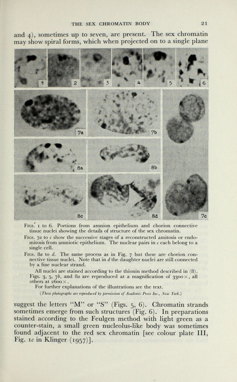 THE SEX CHROMATIN BODY 21 and 4), sometimes up to seven, are present. The sex chromatin may show spiral forms, which when projected on to a single plane Figs, i to 6. Portions from amnion epithelium and chorion connective tissue nuclei showing the details of structure of the sex chromatin. Figs. 7a to с show the successive stages of a reconstructed amitosis or endo- mitosis from amniotic epithelium. The nuclear pairs in с each belong to a single cell. Figs. 8a to d. The same process as in Fig. 7 but these are chorion con¬ nective tissue nuclei. Note that in d the daughter nuclei are still connected by a fine nuclear strand. All nuclei are stained according to the thionin method described in (8). Figs. 3, 5, 7¿, and 80 are reproduced at a magnification of 3300 x, all others at 2600 X . For further explanations of the illustrations see the text. {These photographs are reproduced by permission of Academic Press Inc., New York.) suggest the letters M or S (Figs. 5, 6). Chromatin strands sometimes emerge from such structures (Fig. 6). In preparations stained according to the Feulgen method with light green as a counter-stain, a small green nucleolus-like body was sometimes found adjacent to the red sex chromatin [see colour plate III, Fig. 1С in Klinger (1957)].