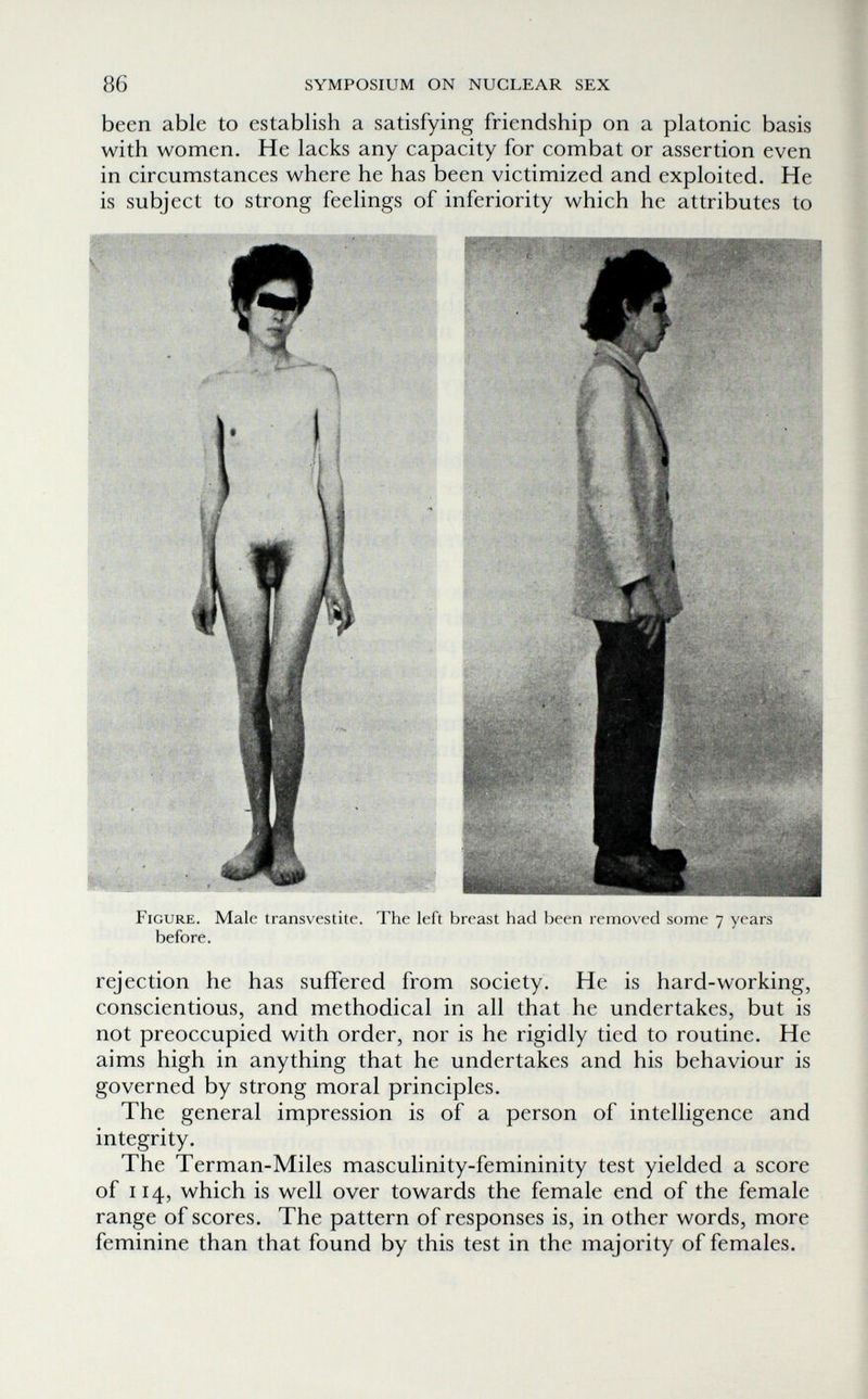 86 SYMPOSIUM ON NUCLEAR SEX been able to establish a satisfying friendship on a platonic basis with women. He lacks any capacity for combat or assertion even in circumstances where he has been victimized and exploited. He is subject to strong feelings of inferiority which he attributes to Figure. Male transvestite. The left breast had been removed some 7 years before. rejection he has suffered from society. He is hard-working, conscientious, and methodical in all that he undertakes, but is not preoccupied with order, nor is he rigidly tied to routine. He aims high in anything that he undertakes and his behaviour is governed by strong moral principles. The general impression is of a person of intelligence and integrity. The Terman-Miles masculinity-femininity test yielded a score of 114, which is well over towards the female end of the female range of scores. The pattern of responses is, in other words, more feminine than that found by this test in the majority of females.