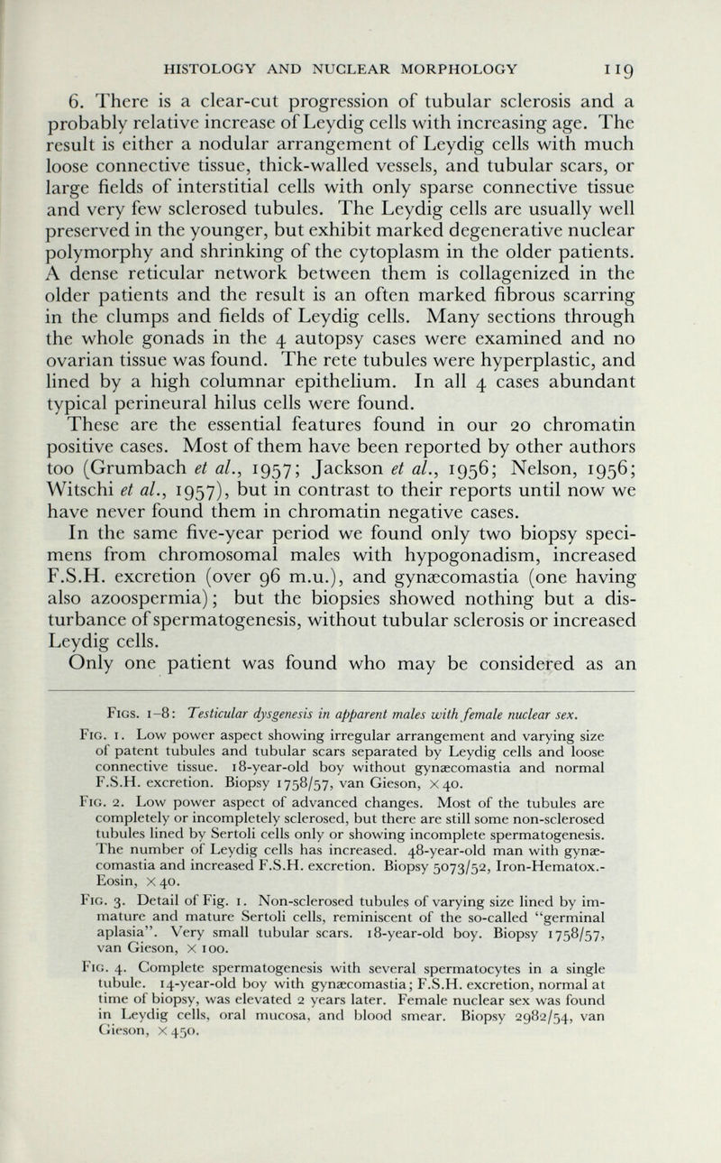 HISTOLOGY AND NUCLEAR MORPHOLOGY Iig 6. There is a clear-cut progression of tubular sclerosis and a probably relative increase of Leydig cells with increasing age. The result is either a nodular arrangement of Leydig cells with much loose connective tissue, thick-walled vessels, and tubular scars, or large fields of interstitial cells with only sparse connective tissue and very few sclerosed tubules. The Leydig cells are usually well preserved in the younger, but exhibit marked degenerative nuclear polymorphy and shrinking of the cytoplasm in the older patients. A dense reticular network between them is collagenized in the older patients and the result is an often marked fibrous scarring in the clumps and fields of Leydig cells. Many sections through the whole gonads in the 4 autopsy cases were examined and no ovarian tissue was found. The rete tubules were hyperplastic, and lined by a high columnar epithelium. In all 4 cases abundant typical perineural hilus cells were found. These are the essential features found in our 20 chromatin positive cases. Most of them have been reported by other authors too (Grumbach et al., i957î Jackson et al., 1956; Nelson, 1956; Witschi et al., 1957), but in contrast to their reports until now we have never found them in chromatin negative cases. In the same five-year period we found only two biopsy speci¬ mens from chromosomal males with hypogonadism, increased F.S.H. excretion (over 96 m.u.), and gynsecomastia (one having also azoospermia) ; but the biopsies showed nothing but a dis¬ turbance of spermatogenesis, without tubular sclerosis or increased Leydig cells. Only one patient was found who may be considered as an Figs. 1-8: Testicular dysgenesis in apparent males with female nuclear sex. Fig. i. Low power aspect showing irregular arrangement and varying size of patent tubules and tubular scars separated by Leydig cells and loose connective tissue. 18-year-old boy without gynaecomastia and normal F.S.H. excretion. Biopsy 1758/57, van Gieson, x 40. Fig. 2. Low power aspect of advanced changes. Most of the tubules are completely or incompletely sclerosed, but there are still some non-sclerosed tubules lined by Sertoli cells only or showing incomplete spermatogenesis. The number of Leydig cells has increased. 48-year-old man with gynae¬ comastia and increased F.S.H. excretion. Biopsy 5073/52, Iron-Hematox.- Eosin, X40. Fig. 3. Detail of Fig. i. Non-sclerosed tubules of varying size lined by im¬ mature and mature Sertoli cells, reminiscent of the so-called germinal aplasia. Very small tubular scars. 18-year-old boy. Biopsy 1758/57, van Gieson, x 100. Fig. 4. Complete spermatogenesis with several spermatocytes in a single tubule. 14-year-old boy with gynaecomastia; F.S.H. excretion, normal at time of biopsy, was elevated 2 years later. Female nuclear sex was found in Leydig cells, oral mucosa, and blood smear. Biopsy 2982/54, van Gieson, X 450.