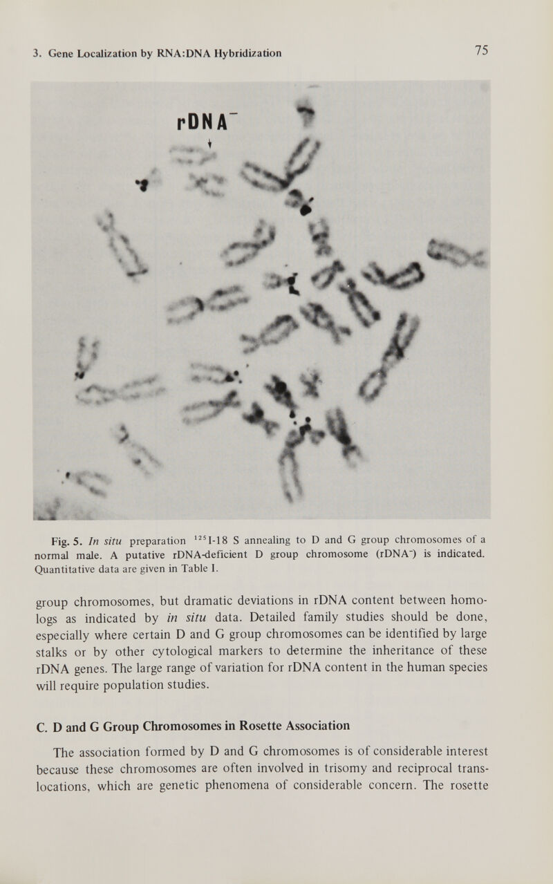 3. Gene Localization by RNA:DNA Hybridization 75 rDNA 1 Fig. 5. In situ preparation Ч-18 S annealing to D and G group chromosomes of a normal male. A putative rDNA-deficient D group chromosome (rDNA) is indicated. Quantitative data are given in Table I. group chromosomes, but dramatic deviations in rDNA content between homo- logs as indicated by in situ data. Detailed family studies should be done, especially where certain D and G group chromosomes can be identified by large stalks or by other cytological markers to determine the inheritance of these rDNA genes. The large range of variation for rDNA content in the human species v^ll require population studies. C. D and G Group Chromosomes in Rosette Association The association formed by D and G chromosomes is of considerable interest because these chromosomes are often involved in trisomy and reciprocal trans¬ locations, which are genetic phenomena of considerable concern. The rosette